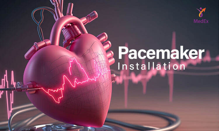 Pacemaker Installation