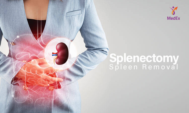 Splenectomy/ Spleen Removal